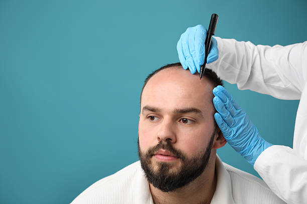 Turkey Hair Transplant Cost: Why Istanbul Is the Best Choice